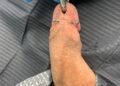 penis piercings