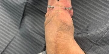 penis piercings