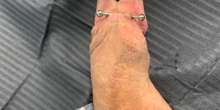 penis piercings