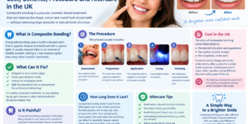Composite bonding infographic showing the procedure, benefits, UK cost, longevity and aftercare for bonded teeth