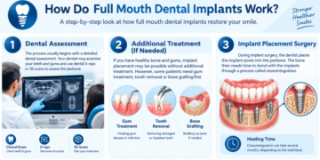 Full mouth dental implants infographic showing treatment process, benefits, UK costs, timeline, aftercare, and FAQs.