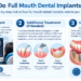 Full mouth dental implants infographic showing treatment process, benefits, UK costs, timeline, aftercare, and FAQs.